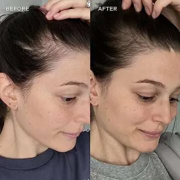 Vida Glow Marine Collagen - Anti Aging Supplement for Glowing Skin