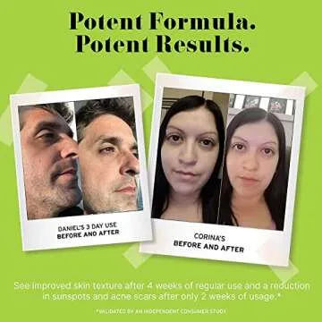 No B.S. (No Bad Stuff) Caffeine Eye Cream with Pure Hyaluronic Acid & Plant Based Squalane Oil, Unde...