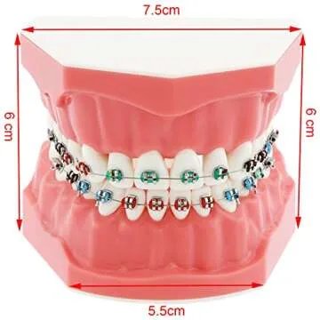 Dentalmall Typodonts Orthodontics Demonstration Model with Metal Wires and Bracket Teaching, Learning, Interpretation Model for Adults and Children (Metal Bracket)