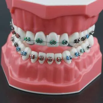 Dentalmall Typodonts Orthodontics Demonstration Model with Metal Wires and Bracket Teaching, Learning, Interpretation Model for Adults and Children (Metal Bracket)