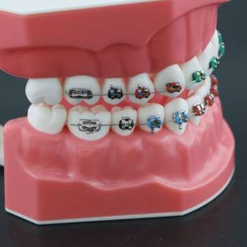 Dentalmall Typodonts Orthodontics Demonstration Model with Metal Wires and Bracket Teaching, Learning, Interpretation Model for Adults and Children (Metal Bracket)