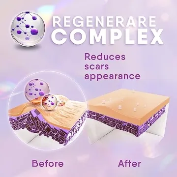 Cicatricure Advanced Scar Gel for Old & New Scars 1 oz