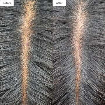 Briogeo Scalp Revival Charcoal + Tea Tree Cooling Hydration Scalp Mask, Dry Scalp Treatment and Moisturizer, Soothes Flaky, Itchy Scalp, 2 oz