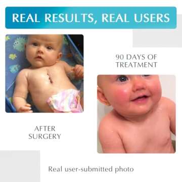 Advanced Silicone Scar Treatment Sheets for Effective Healing