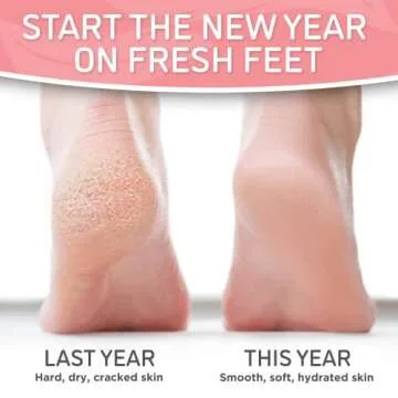 Soft Touch Foot Peel Mask for Soft, Smooth Feet - Pack of 2