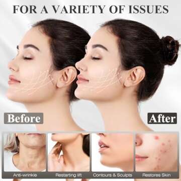 Chin Strap for Sleeping,Adjustable Chin Strap,Jaw Strap,Jawline Shaper,V Line Lifting Mask,Deep Black,M