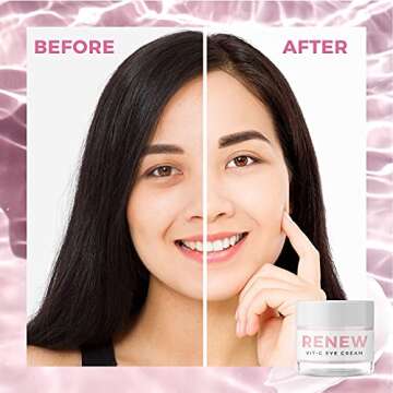 Teami Renew Eye Cream - Facial Skin Care Products - Under Eye Cream for Dark Circles and Puffiness Treatment for Women - Eye Cream Anti Aging Bags & Dark Circle Brightening with Niacinamide & Vit-C