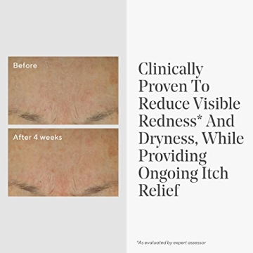 Murad Eczema Control Colloidal Oatmeal Cream - Skin Relief Moisturizer