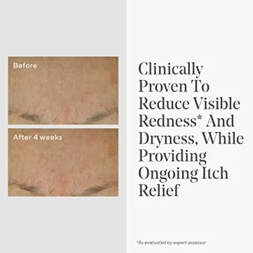 Murad Eczema Control Colloidal Oatmeal Cream - Skin Relief Moisturizer