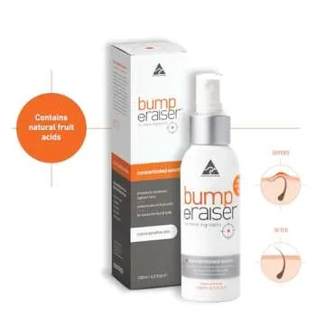 Bump Eraiser Concentrated Ingrown Hair Serum 4.2 fl oz for Ingrown Hair Treatment, Razor Burns and Razor Bumps