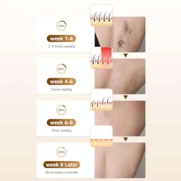 Rodzon IPL Hair Removal Device for Painless At-Home Use