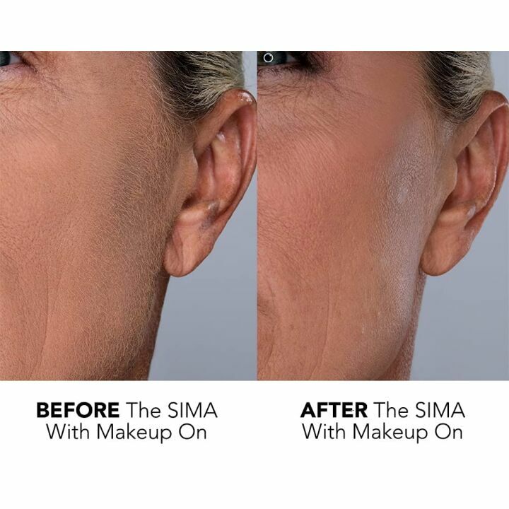 SIMA Dermaplaning Tool