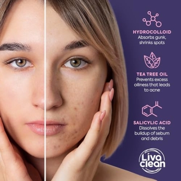 LivaClean Star Pimple Patches - 240 Hydrocolloid Stickers