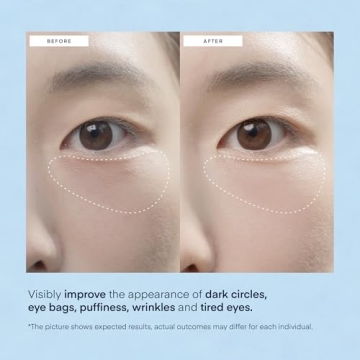 Korean Under Eye Patches for Dark Circles & Puffiness