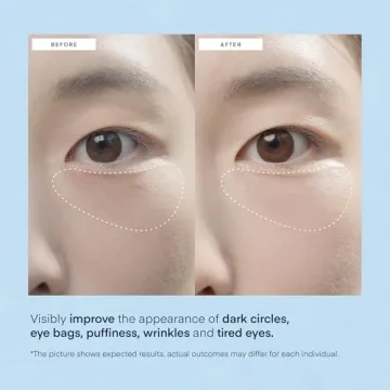 Korean Under Eye Patches for Dark Circles & Puffiness