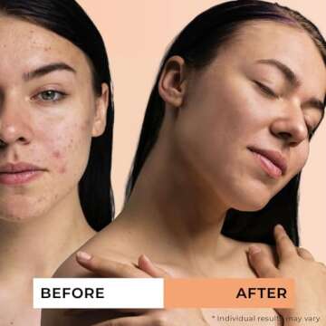 Jeune Naturelle Sea Buckthorn Oil Organic, From Fruit & Seeds, 100% Pure RAW Virgin Cold-Pressed Undiluted Unrefined, Fast Absorbing, Travel Size, Non-Comedogenic