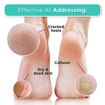 DERMORA Foot Peel Mask - 2 Pack of Regular Size Skin Exfoliating Foot Masks for Dry, Cracked Feet, Callus, Dead Skin Remover for baby soft feet, Peach Scent