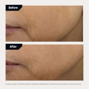 Revision Skincare D·E·J Face Cream®, Advanced Anti Aging Moisturizer, Lifting and Firming, Antioxidant Rich, 1.7 oz