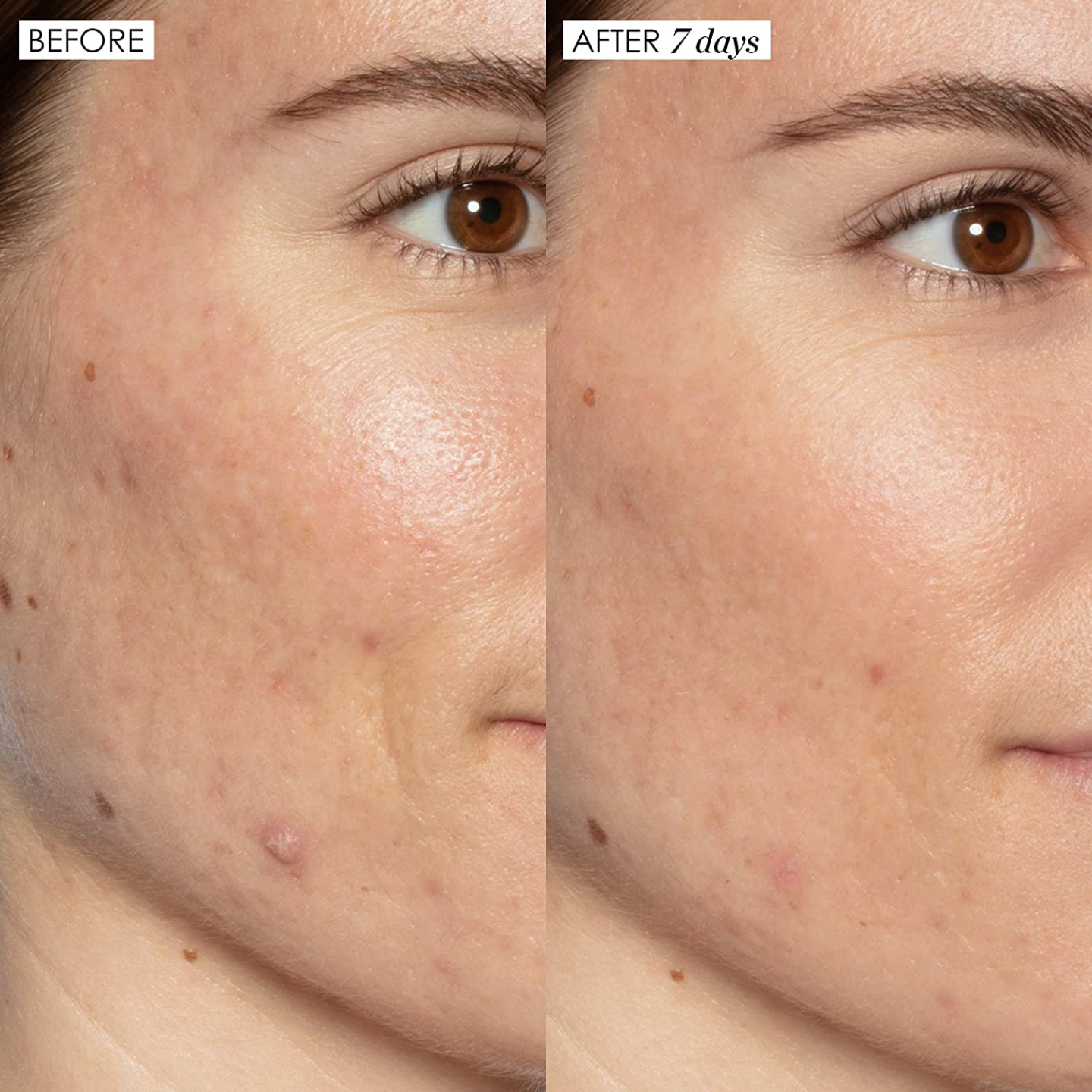 Sunday Riley Good Genes Lactic Acid Serum 50ml