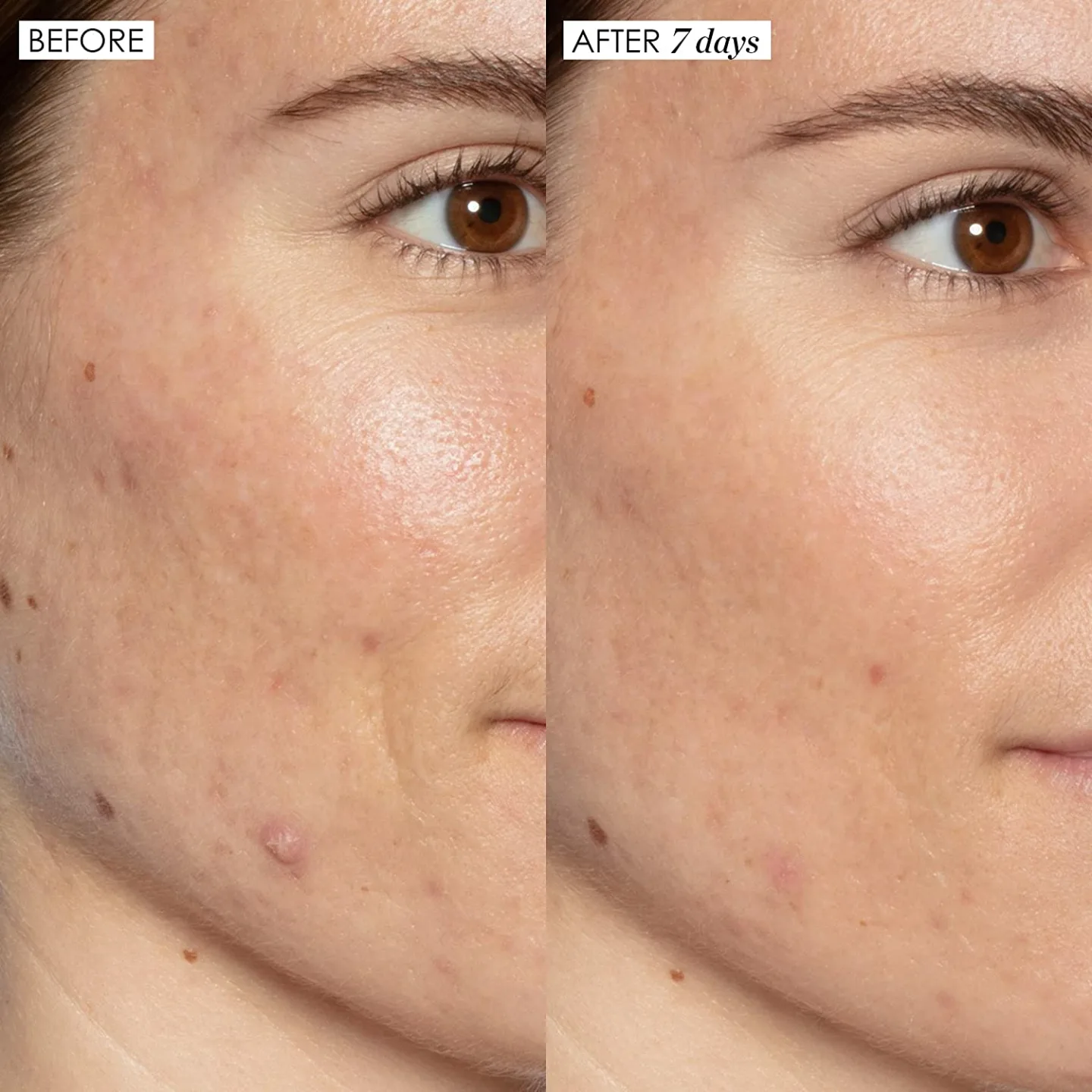 Sunday Riley Good Genes Lactic Acid Serum 50ml