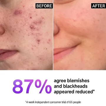 The INKEY List Salicylic Acid Cleanser for Clear Skin