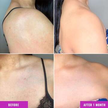 Good Molecules Discoloration Correcting Body Treatment - Cream with Tranexamic Acid Ester Salt, LHA, and Niacinamide - Anti-aging Skincare for Body