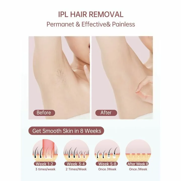 At-Home IPL Hair Removal Device with 999,900 Flashes