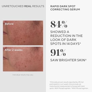 Murad Rapid Dark Spot Correcting Serum for Radiant Skin