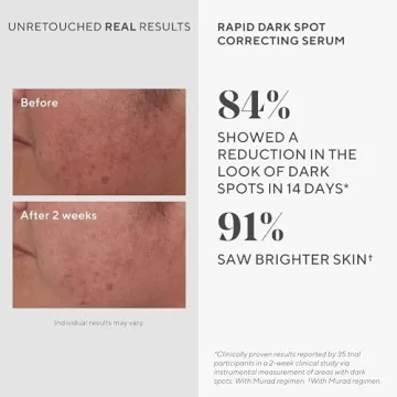 Murad Rapid Dark Spot Correcting Serum for Radiant Skin
