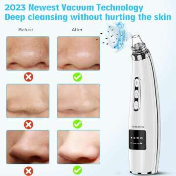 Blackhead Remover Vacuum - 2023 USB Rechargeable