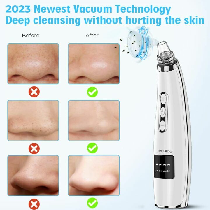 Blackhead Remover Vacuum - 2023 USB Rechargeable