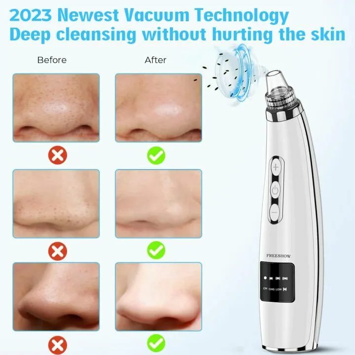 Blackhead Remover Vacuum - 2023 USB Rechargeable