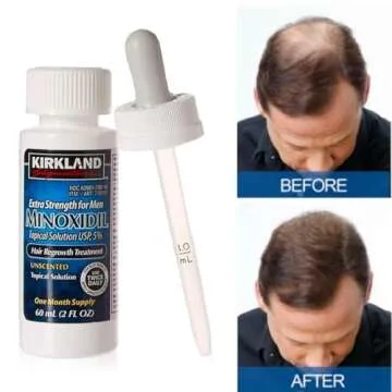 Kirkland Signature Minoxidil 5% Solution Men’s Hair Regrowth