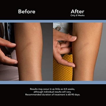 ScarAway Silicone Scar Sheets for Effective Scar Treatment