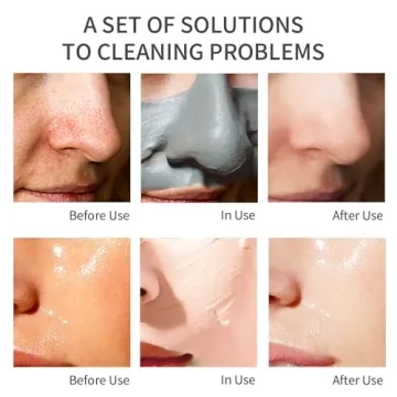 ClayCo! 10 Piece Clay Mask Set for Radiant Skin