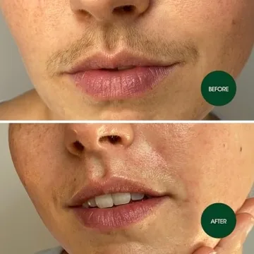 Nad's Facial Wax Strips for Easy Hair Removal at Home