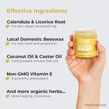 Ora's Amazing Herbal Touchy Skin Salve for Eczema Relief