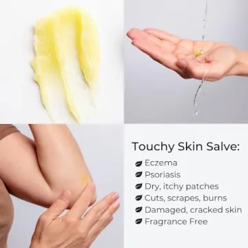 Ora's Amazing Herbal Touchy Skin Salve for Eczema Relief