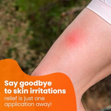 Get Fast Relief with Avedana Hydrocortisone Ointment 1oz