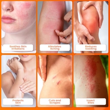 Get Fast Relief with Avedana Hydrocortisone Ointment 1oz