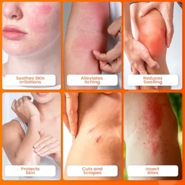 Get Fast Relief with Avedana Hydrocortisone Ointment 1oz