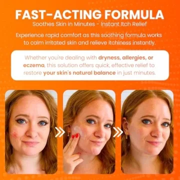 Get Fast Relief with Avedana Hydrocortisone Ointment 1oz