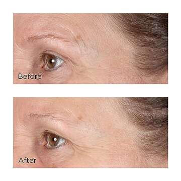 Vitamin C Ester Daily Brightening & Exfoliating Peel, 2 fl. oz.