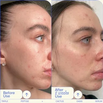 Youth To The People Vegan Skincare Duo for Hydrated Skin