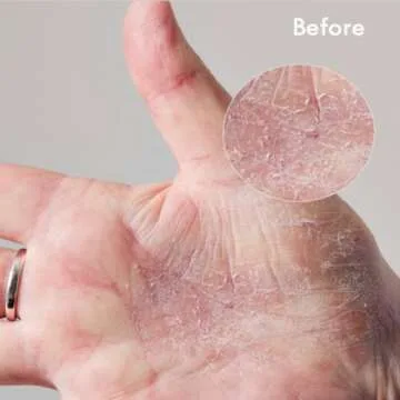 Lanolips 101 Dry Skin Super Cream - Body Cream & Face Moisturizer - Whipped Body Butter for Dry Skin - Triple Lanolin, Sweet Almond Oil, Shea Butter & Vitamin E Infused Body Care (2.02 oz)