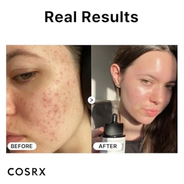 COSRX 15% Niacinamide Face Serum Pore Minimizer Even Skin Tone