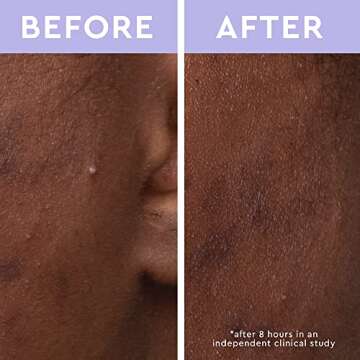 florence by mills Spot A Spot Acne Patches | Remove Dirt + Oil | Salicylic Acid + Hydrocolloid | Peppermint Oil + Tea Tree Oil | Vegan & Cruelty-Free - 36 stickers…