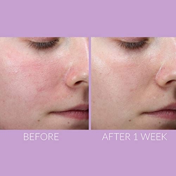 DeliKate Recovery Serum: Ultimate Hydration & Relief