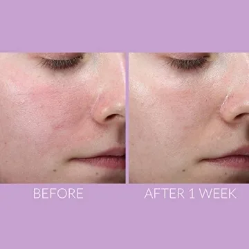 DeliKate Recovery Serum: Ultimate Hydration & Relief