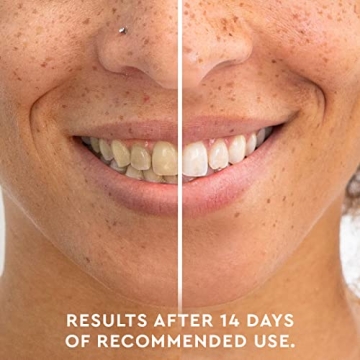 MOON Teeth Whitening Pen for a Brighter Smile